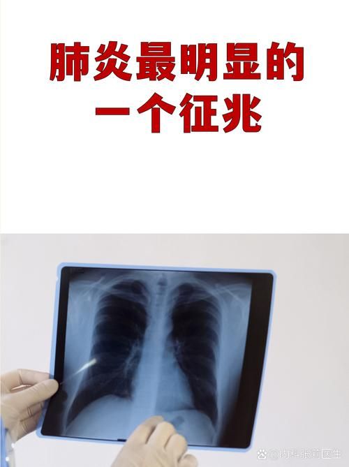 江西鹰潭余江区通报5例无症状感染者详情:江西鹰潭确诊新型肺炎