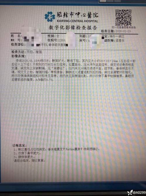  广东深圳光明区累计报告本土确诊19例:深圳光明区确诊病例