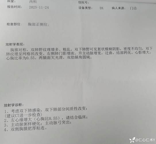  大庆市首例重症来源公布:大庆首例新型冠状肺炎