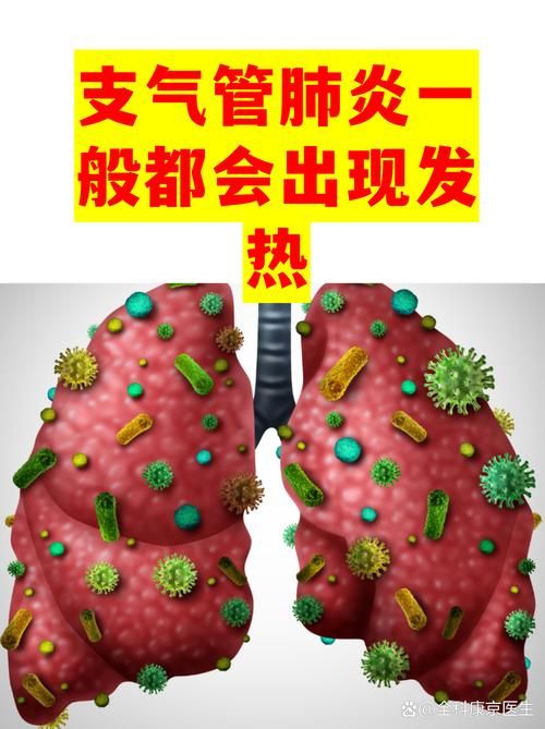 【专家:寮步镇每年或现多个感染高峰,寮步有没有新型肺炎】